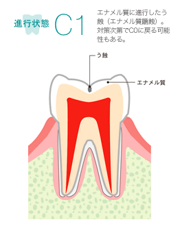 進行状態C1　イメージ