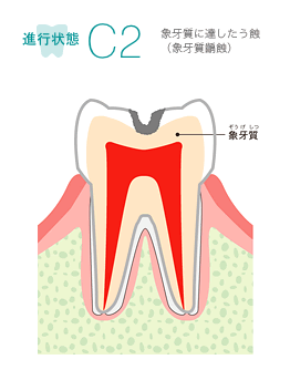 進行状態C2　イメージ