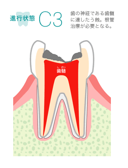 進行状態C3　イメージ