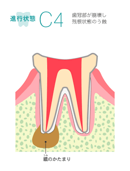 進行状態C4　イメージ